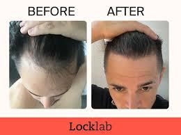 locklab hair user reviews explained